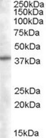 SNX16 Antibody in Western Blot (WB)