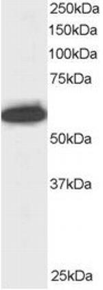 NUP50 Antibody in Western Blot (WB)