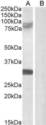 TRIM2 Antibody in Western Blot (WB)
