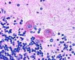 SNX26 Antibody in Immunohistochemistry (Paraffin) (IHC (P))