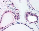 TRIP15 Antibody in Immunohistochemistry (Paraffin) (IHC (P))