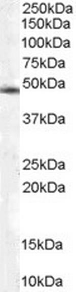 TRIP15 Antibody in Western Blot (WB)