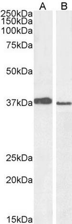 MEL18 Antibody in Western Blot (WB)