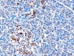MDA5 Polyclonal Antibody