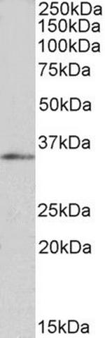 FOXB1 Polyclonal Antibody