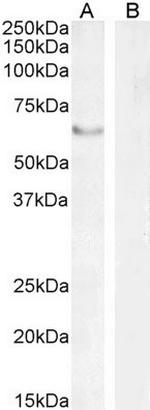 FOXC2 Polyclonal Antibody
