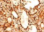 FOXE1 Antibody in Immunohistochemistry (Paraffin) (IHC (P))