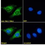 FBXL2 Polyclonal Antibody