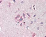 FBXL2 Antibody in Immunohistochemistry (Paraffin) (IHC (P))