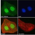 FBXO44 Polyclonal Antibody