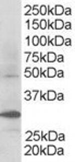FBXW2 Antibody in Western Blot (WB)