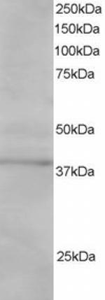 SAE1 Polyclonal Antibody