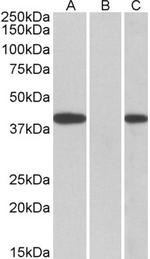 FANCF Polyclonal Antibody