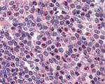 FANCG Antibody in Immunohistochemistry (Paraffin) (IHC (P))