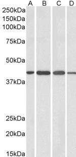 Centaurin alpha-1 Polyclonal Antibody