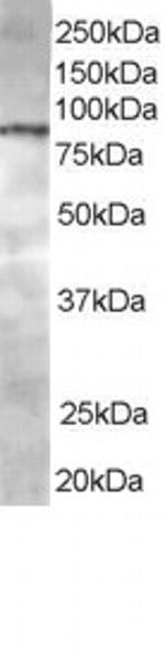 CENTB1 Antibody in Western Blot (WB)