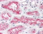 CENTG3 Polyclonal Antibody