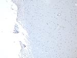MUNC18 Antibody in Immunohistochemistry (Paraffin) (IHC (P))