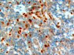 NET1 Antibody in Immunohistochemistry (Paraffin) (IHC (P))