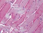 ORP1 Antibody in Immunohistochemistry (Paraffin) (IHC (P))