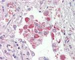 ORP9 Antibody in Immunohistochemistry (Paraffin) (IHC (P))