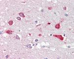 ORP9 Antibody in Immunohistochemistry (Paraffin) (IHC (P))