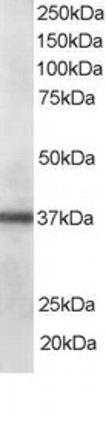 PDLIM1 Antibody in Western Blot (WB)