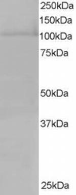 RanBP16 Antibody in Western Blot (WB)