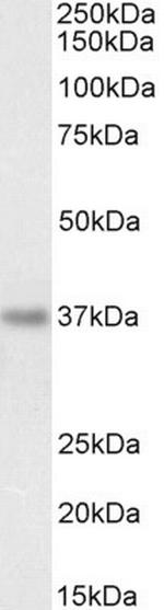 PDLIM4 Antibody in Western Blot (WB)