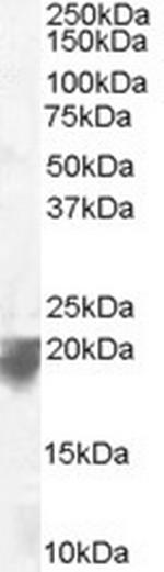 VPS29 Polyclonal Antibody