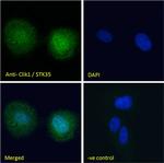STK35 Polyclonal Antibody