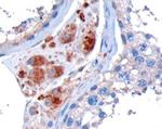 STK35 Antibody in Immunohistochemistry (Paraffin) (IHC (P))