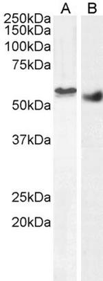 STK35 Antibody in Western Blot (WB)