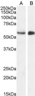 STK35 Antibody in Western Blot (WB)