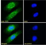 TCP1 Polyclonal Antibody