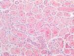 TCP1 Antibody in Immunohistochemistry (Paraffin) (IHC (P))
