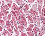 PIK3C2A Antibody in Immunohistochemistry (Paraffin) (IHC (P))