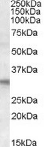 FHL2 Polyclonal Antibody