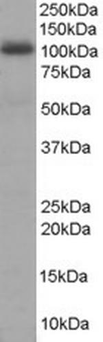 AKAP8 Polyclonal Antibody