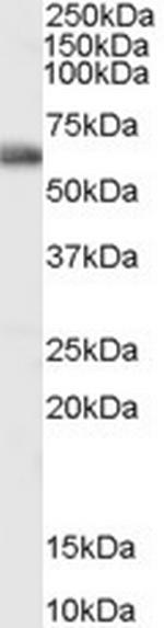 MUTYH Polyclonal Antibody