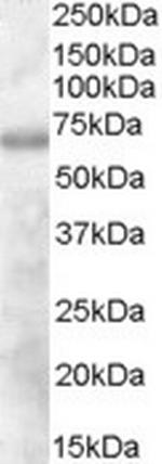 DEF6 Antibody in Western Blot (WB)