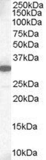 MCL-1 Polyclonal Antibody
