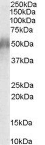 CD2BP2 Antibody in Western Blot (WB)