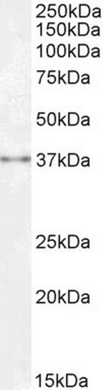 SPRY1 Antibody in Western Blot (WB)