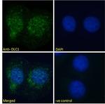 DLC1 Polyclonal Antibody