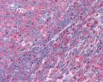 FNBP1 Antibody in Immunohistochemistry (Paraffin) (IHC (P))