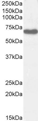 EHD2 Antibody in Western Blot (WB)