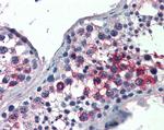 FHL1 Antibody in Immunohistochemistry (Paraffin) (IHC (P))