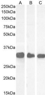 FHL1 Antibody in Western Blot (WB)