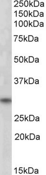 FHL3 Polyclonal Antibody